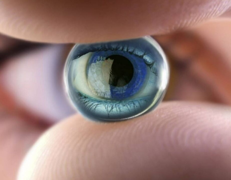 Orthokeratology night lenses will stop the progress of visual impairment